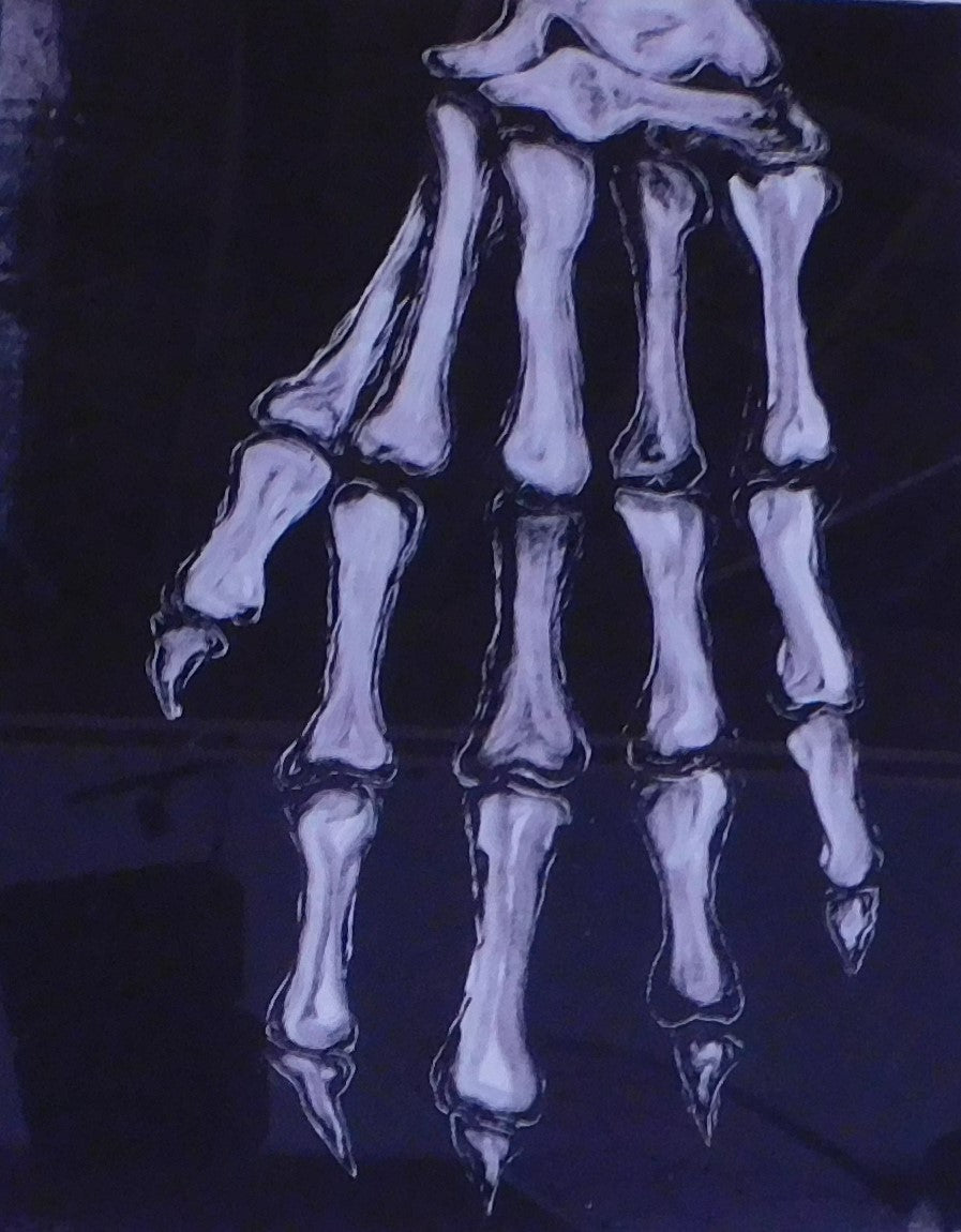 Rachel McCoy - X-ray